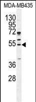 1 - CCNB1 Antibody (Center) AP11096c
