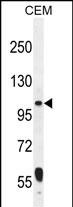 1 - LARS2 Antibody (Center) AP11098c