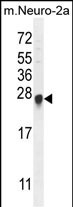 1 - C15orf24 Antibody (Center) AP11145c