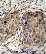 14 - JAGN1 Antibody  (N-term) AP11155a
