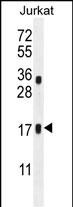 1 - JAGN1 Antibody  (N-term) AP11155a
