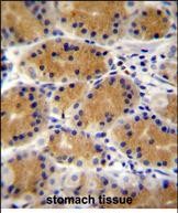 14 - PLEKHG3 Antibody (C-term) AP11167b