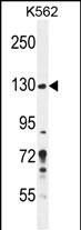 1 - PLEKHG3 Antibody (C-term) AP11167b