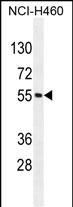 1 - MIER2 Antibody (N-term) AP11173a