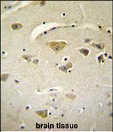 14 - VSTM2A Antibody (Center) AP11175c