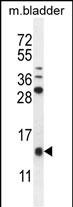 1 - KTAP2 Antibody  (C-term) AP11178b