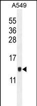 1 - KTAP2 Antibody  (C-term) AP11178b