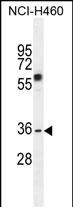 1 - C10orf72 Antibody (Center) AP11192c