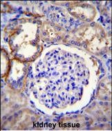 14 - FA96A Antibody  (C-term) AP11250b
