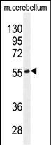 1 - FAM69B Antibody (N-term) AP11279a
