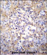 14 - TSNARE1 Antibody (C-term) AP11310b