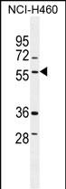 1 - TSNARE1 Antibody (C-term) AP11310b