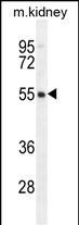 1 - FBXO47 Antibody (N-term) AP11336a