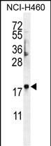 1 - C4orf39 Antibody (C-term) AP11347b