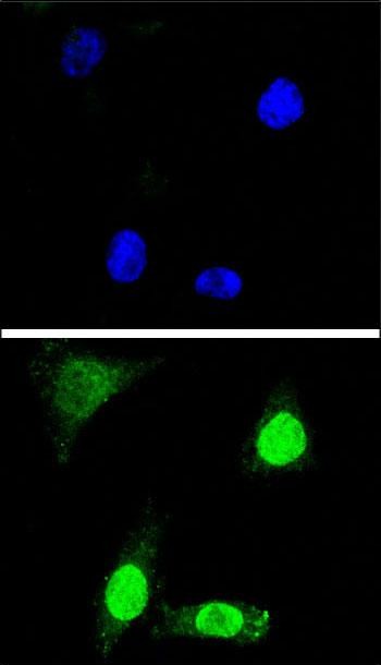 3 - WDR70 Antibody (C-term) AP11355B