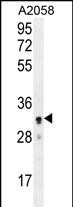 1 - UBXN2A Antibody (C-term) AP11361b