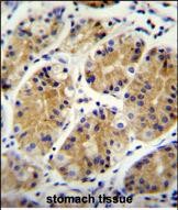 14 - MGC24975 Antibody (C-term) AP11386B