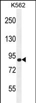 1 - AGAP9 Antibody (N-term) AP11394a