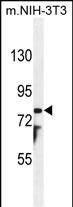 1 - PTCHD1 Antibody (Center) AP11396c