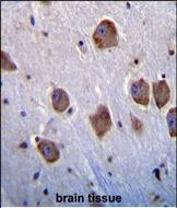 14 - NT5DC4 Antibody (Center) AP11408c