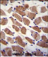 14 - SAMD7 Antibody (Center) AP11411c