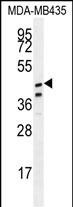 1 - SAMD7 Antibody (Center) AP11411c