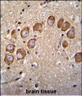 14 - VSTM2B Antibody (N-term) AP11415a