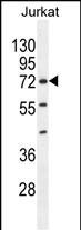 1 - ZNF648 Antibody (N-term) AP11416a