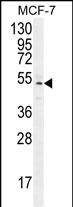 1 - ZNF829 Antibody (Center) AP11427c