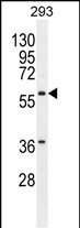 1 - CPA2 Antibody (Center) AP11457c
