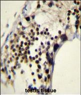 14 - RACGAP1 Antibody (N-term) AP11461a