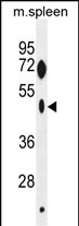 1 - ZNF385C Antibody (N-term) AP11482a