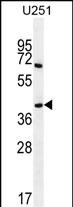 1 - PRR16 Antibody (C-term) AP11498b