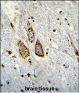 14 - C2orf85 Antibody (C-term) AP11513b