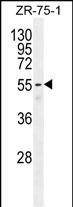 1 - C2orf85 Antibody (C-term) AP11513b