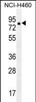 1 - ZNF28 Antibody (N-term) AP11536a