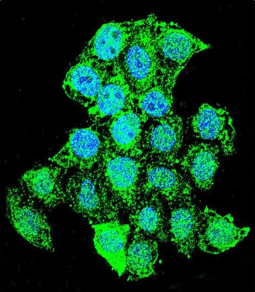 3 - ZMYND17 Antibody (C-term) AP11600B