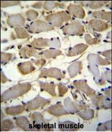 14 - ZMYND17 Antibody (C-term) AP11600B