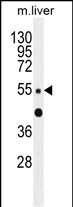 1 - ZNF672 Antibody (C-term) AP11617b