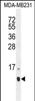1 - HCFC1R1 Antibody (N-term) AP11644A