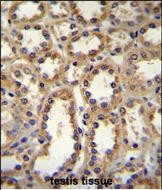 14 - GPC6 Antibody (C-term) AP11674b