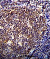 14 - HOXB6 Antibody (Center) AP11711C