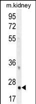 1 - HOXB6 Antibody (Center) AP11711C
