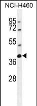 1 - SRD5A2L2 Antibody (C-term) AP11735b