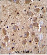 14 - C2orf57 Antibody (C-term) AP11749b