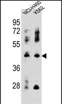 1 - C2orf57 Antibody (C-term) AP11749b
