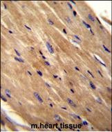 14 - RHOJ Antibody (Center) AP11763c