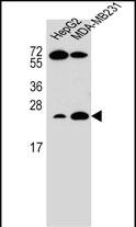 1 - RHOJ Antibody (Center) AP11763c