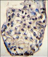 14 - ODF3 Antibody (C-term) AP11800b
