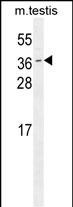 1 - ODF3 Antibody (C-term) AP11800b